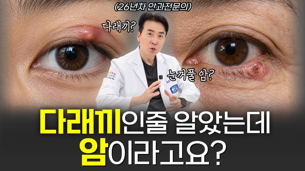 다래끼와 눈꺼풀 혹을 비교해 설명하는 박성진 원장