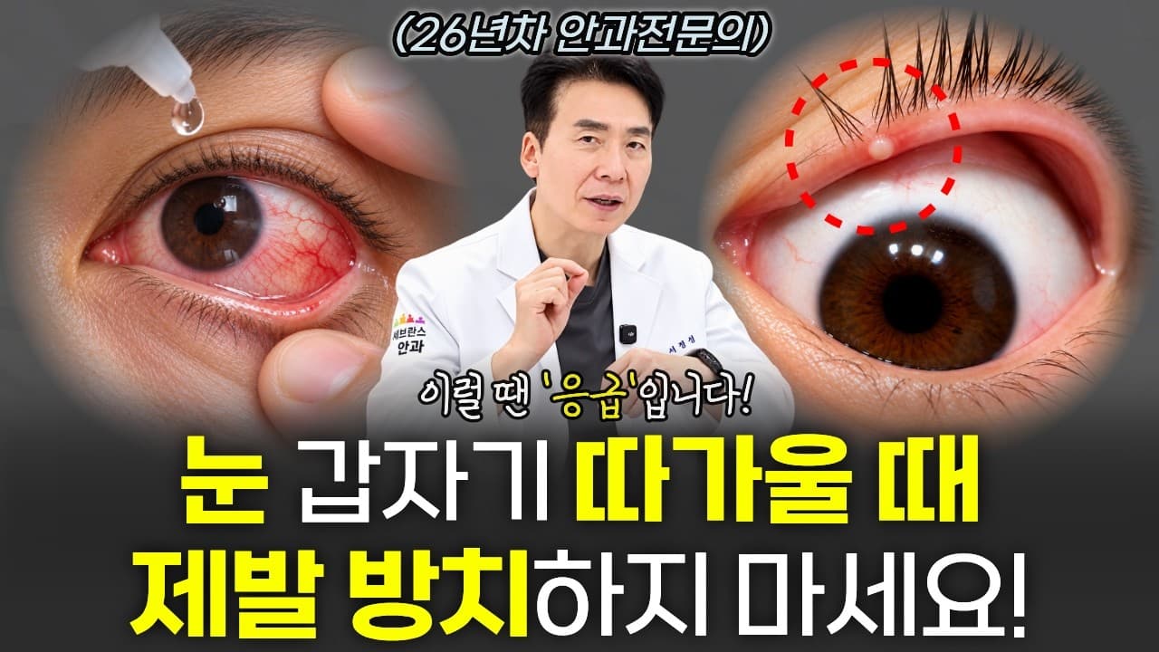 눈이 갑자기 따가울 때 원인을 설명하는 박성진 원장