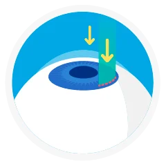 수술 순서 01