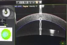 AL SCAN 검사